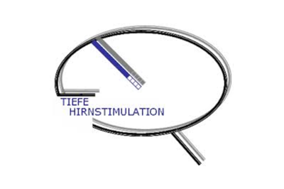 Neurozentrum - tiefe Hirnstimulation