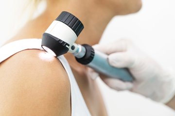 Dermatochirurgie Untersuchung der Schulter