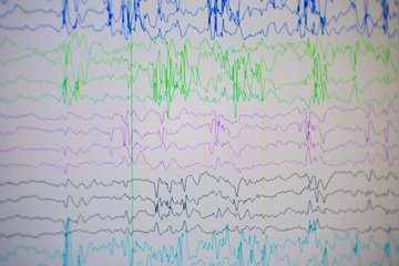Neuropsychologie - Abbildung EEG